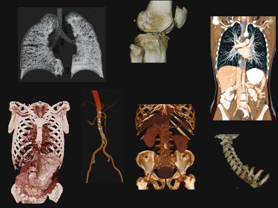 Clinical X-Ray Computed Tomography 79 Fig. 7.21. Routine data acquired on a 16-slice CT scanner. Not only the quality of the CT images themselves but also the display techniques have been improved.