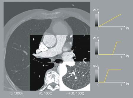 The CT images are usually displayed as gray-scale images. A mapping of the CT values to gray values must be performed when displaying the data.