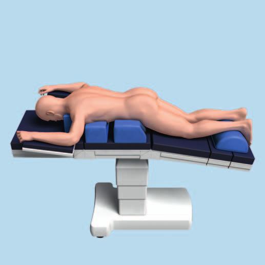 Preparation 1 Patient positioning Position the patient on a radiolucent OR table in the prone position.
