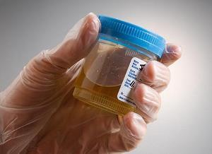 Patient Testing Procedure Urine specimens should be in a container that permits full immersion of the test