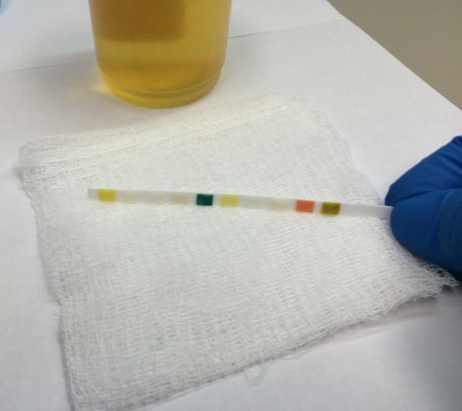 Patient Testing Procedure Remove excess urine by tilting the