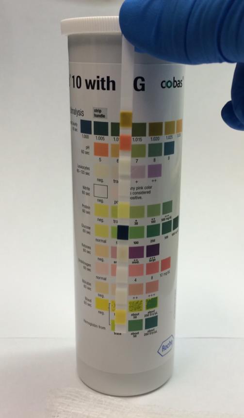 Patient Testing Procedure Results are to be read at 60 seconds. Hold the strip close to the color blocks on Chemstrip 10 container.