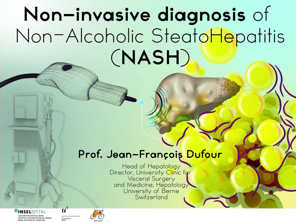 Paris Hepatology Conference PROGNOSIS OF NASH Palais des