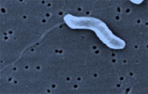 Campylobacter Jejuni Why it's a Threat Campylobacter is the most common bacterial cause of diarrhea in the United States; over 2 million cases are reported each year.