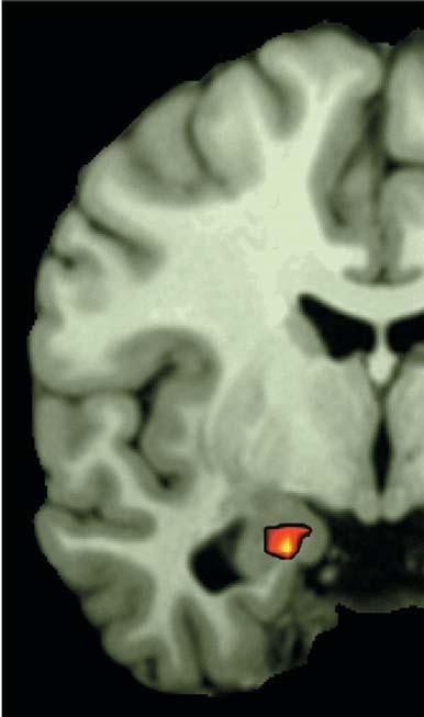 SPECIFICITY IN MAMMALIAN CEREBRAL HEMISPHERES Functional magnetic resonance imaging (fmri) is another technique to pinpoint brain activity.