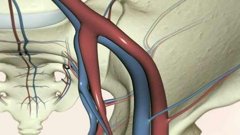 Vascular stent design matters Stent design should accommodate natural