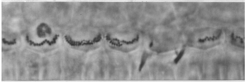 Auditory Nerve Fiber Responses From Damaged Cochleae Normal OHC slide courtesy of Chris Brown, Mass Eye & Ear IH C IHC Stereocilia Damage OHC Damage Massive IHC Stereocilia