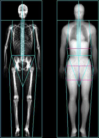 EXPLORATORY OUTCOMES Body Composition Duel Energy X-Ray Absorptiometry (DXA) Total