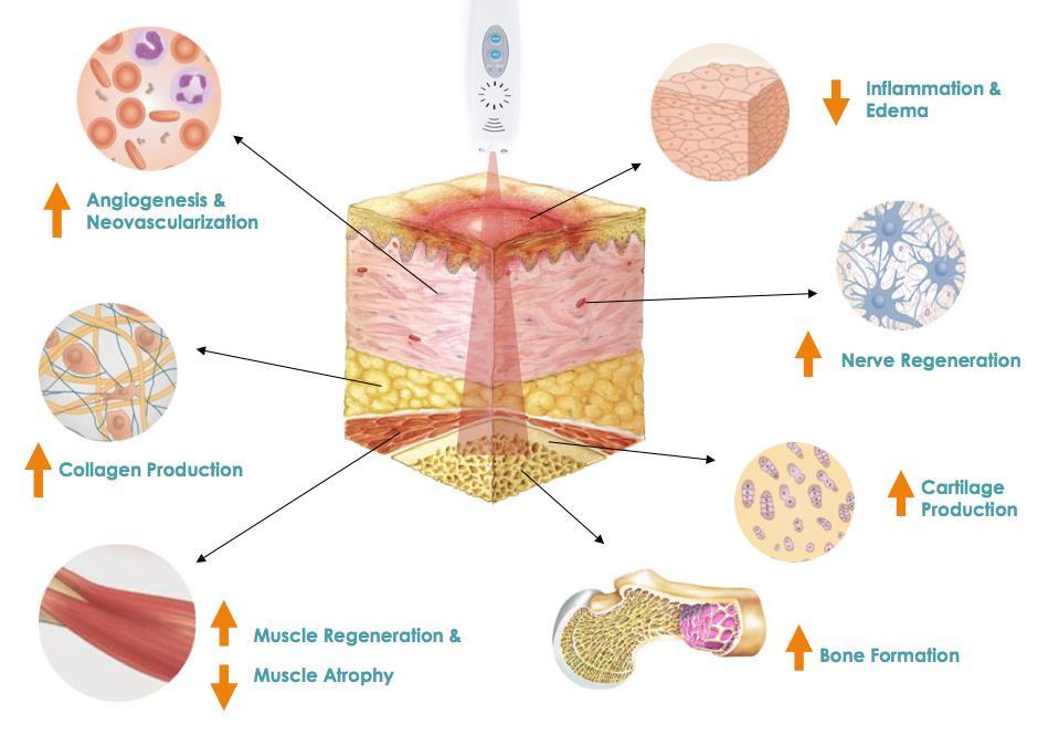 Biostimulation 14 - Dermatology is one of the few medical