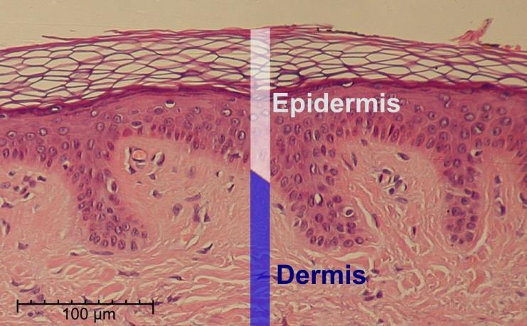 Epidermis 4 - Outer layer of the skin - Barrier to infection from