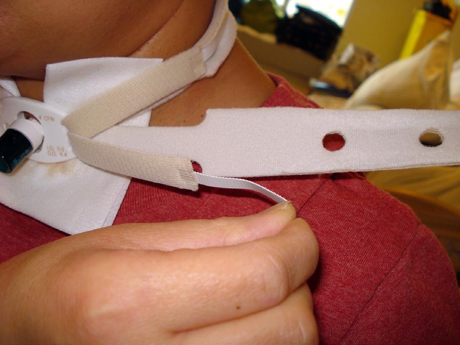 Fold back the end of the Velcro tie until it sticks to the