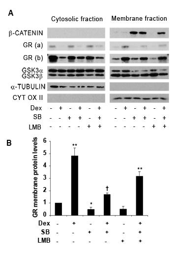 Analysis of the role of GSK3 on glucocorticoid-mediated signaling Figure 45. Subcellular localization of the GR in Jurkat GR wt cells treated with dexamethasone, SB216763 and leptomycin B.
