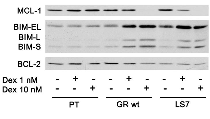 Analysis of the effect of Glucocorticoids in Jurkat Parental, GR wt and LS7 cells Figure 23. BIM and MCL-1 protein levels are modulated by GCs in Jurkat GR wt and LS7 cells.