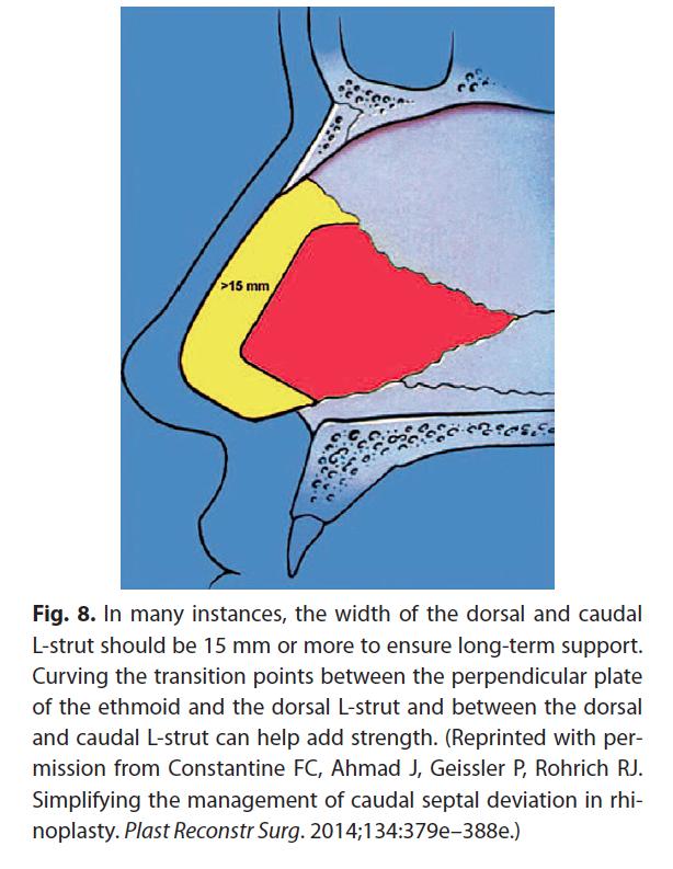Figure 9. (Left) Width of dorsal and caudal L strut should be at least 15 mm to ensure long-term support.