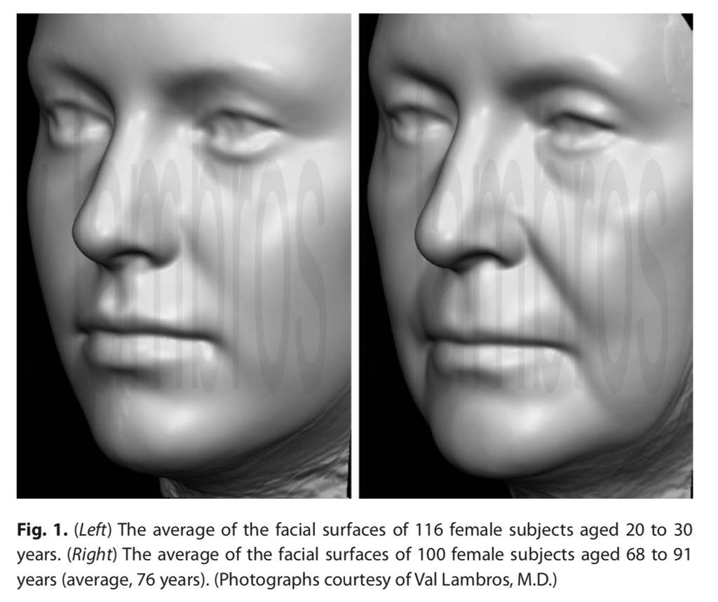 III. FACELIFT A. Facial Aging surface anatomy (Figure 3) 1. The human face will age in predictable patterns 2. Common patterns of aging a. Descent and deflation of the midface b.