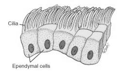 Cells of the meninges/brain sinuses Line Fluid Filled Spaces in the