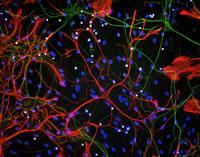 and microfilaments particularly prominent in axons