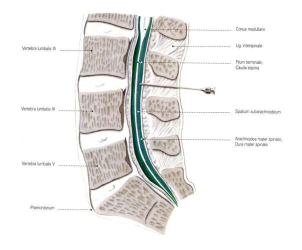 Lumbar Puncture