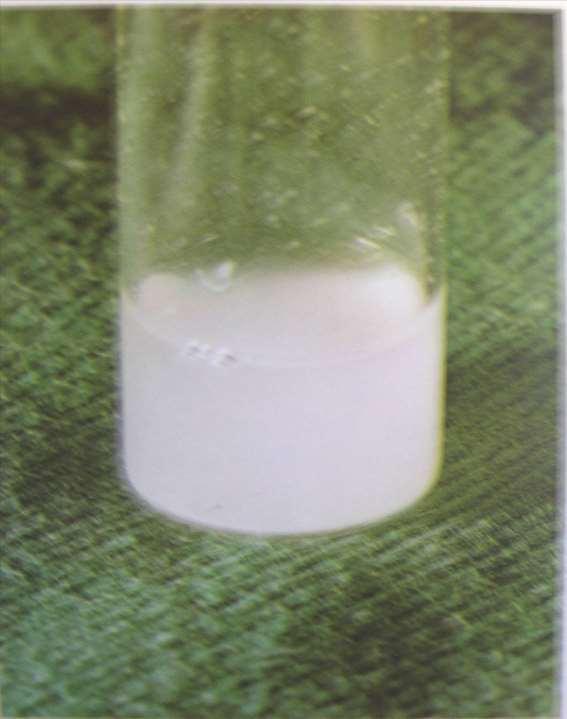 Spinal fluid is normally crystal clear like water.