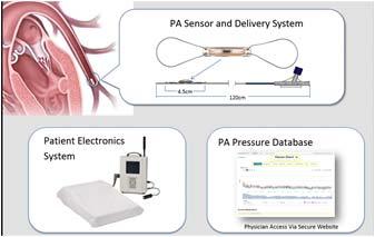Device is implanted in the left PA and provides immediate assessment of PA systolic, diastolic and mean PA pressure that can monitored over time FDA approved in 2014 Indicated for HFpEF & HFrEF