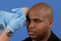 Skin Temperature Assessed by placing the back of your hand on the patient s skin When the EMT wears gloves, it may be necessary to pull the back of the glove down to assess skin temperature and