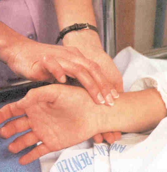 o MOST COMMON SITE USED FOR TAKING A PULSE o CAN BE TAKEN WITHOUT DISTURBING OR EXPOSING THE PERSON o PLACE THE FIRST TWO OR THREE FINGERS OF ONE HAND AGAINST THE RADIAL ARTERY