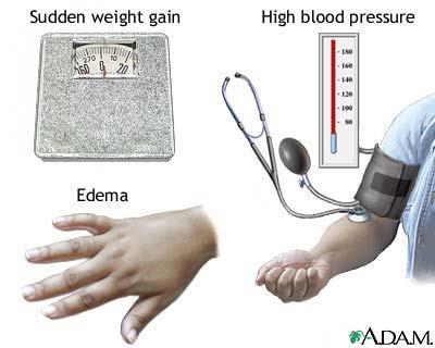 Blood pressure may be affected by many