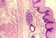 glands, cartilage Esophageal squamous cells - EUS