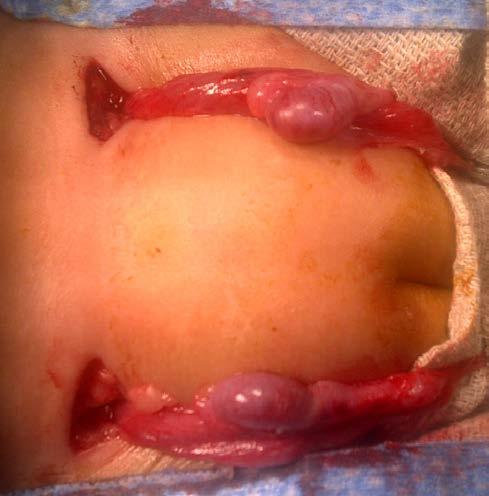 Clitoral hypertrophy of any degree Abnormal vulva