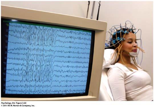 Electroencephalography (EEG) -measure electric fields at surface of scalp -moderate