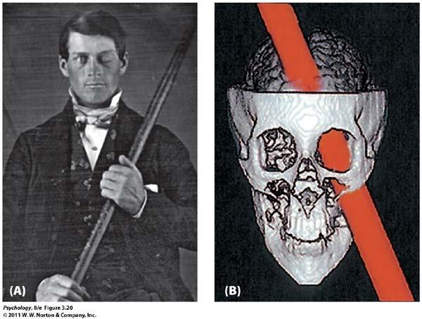 Studying the Nervous System Phineas Gage suffered severe damage to his left frontal lobe due to the passage of an iron rod through this head.