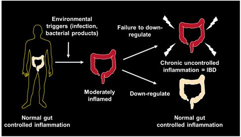 Normal vs inflammatory bowel disease Environmental triggers Clinical Features: UC vs CD Ulcerative