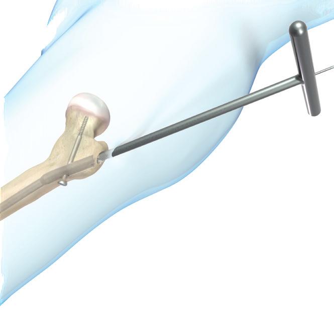 8 NAIL REMOVAL 1 Note: For nail removal, the Bullet Tipped Extractor or Extraction Bolt may be used. The Bullet Tipped Extractor is not standard in the set.
