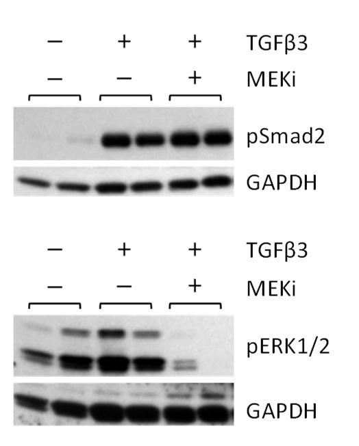Supplemental Figure 6 No stim TGFβ3 TGFβ3 + psmad2/gapdh perk1/2/gapdh TGFβ3 + _ + + TGFβ3 + _ + + Supplemental Figure 6.