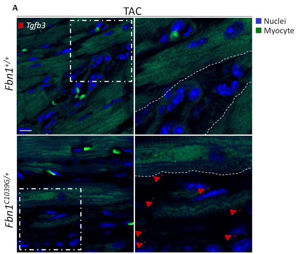 Supplemental Figure 10 B Myocyte enriched DAPI D Myocyte Fold increase Vim Tgfb3/GAPDH Nonmyocyte enriched Tgfb3 Myocyte Fibroblast Fold increase Fbn1C1039G/+: C Vim/GAPDH A Myocyte Fibroblast