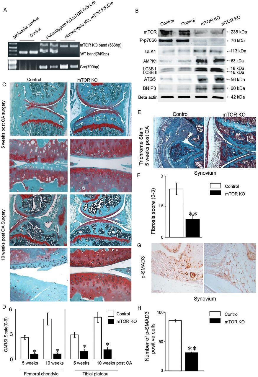 Figure 5 Inducible cartilage-specific mtor KO mice exhibit protection from DMM-induced OA In closing, this study for the first time provides a direct evidence of the in vivo role of mtor in articular