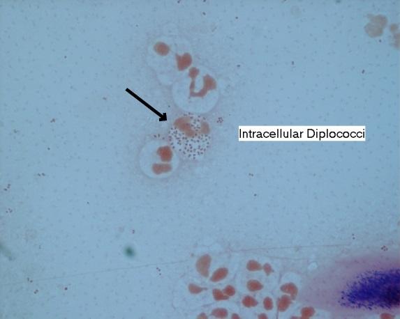 Community Clinic staff (left), gram stain for rectal