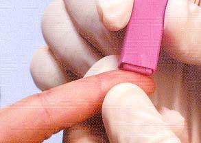 Patient preparation for lancing Sites for lancing avoid using the forefinger and thumb.
