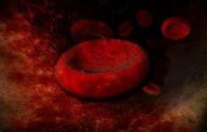 Hemolytic anemia Premature destruction of RBC s Treatment: blood