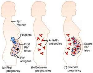 Rh factor/erythroblastosis fetalis Is a hemolytic disease of a newborn (1 st pregnancy) Rh- mom pregnant with Rh+ fetus = anti-rh antibodies for mom; (2 nd pregnancy)