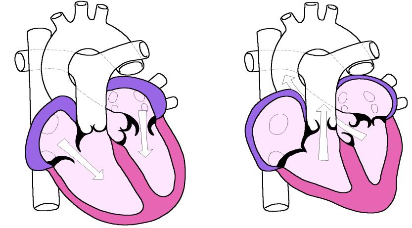 Hear the beat! The valves make a sound when they close referred to as the lubb dupp sounds. The lubb sound is heard first. It is made by the tricuspid and bicuspid valves closing.