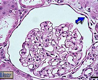 Simple Squamous Epithelium Appearance: Single layer of