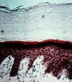 Stratified Squamous Epithelium Microscopic Appearance: Multiple cell layers with cells becoming flatter toward surface.