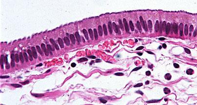 Simple Columnar Epithelium Appearance: Single layer of tall, narrow cells.