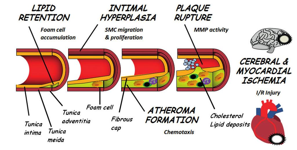 Fig 1: A cross section of an artery, showing the tunica intima (inner layer), tunica media (middle layer) and adventitia (outer layer).