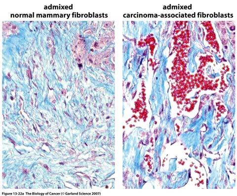 Carcinoma-associated fibroblasts (CAF) initiate angiogenesis by recruiting endothelial