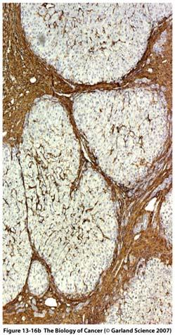 muscle actin (SMA) red infiltrate wound at