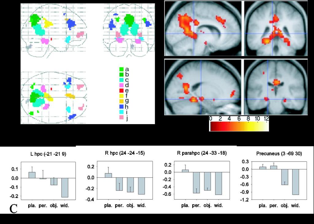 Neuroimaging of the retrieval of the