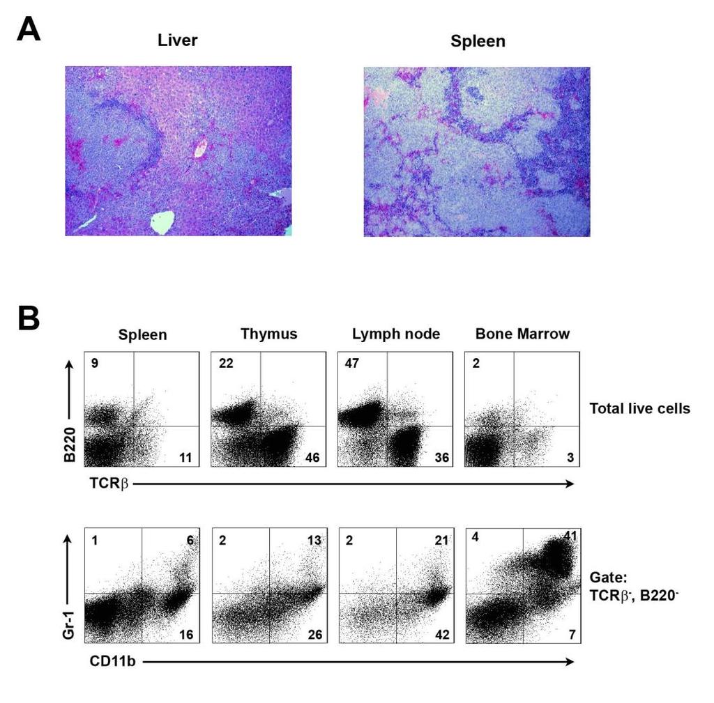 Figure 35. NF1-deficient RASA1 heterozygous mice develop mixed/myeloid dysplastic syndromes.