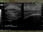 Diagnostic Approach - Ultrasonography